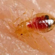 Illustration for article titled Inbreeding is whats secretly driving all the bedbug infestations